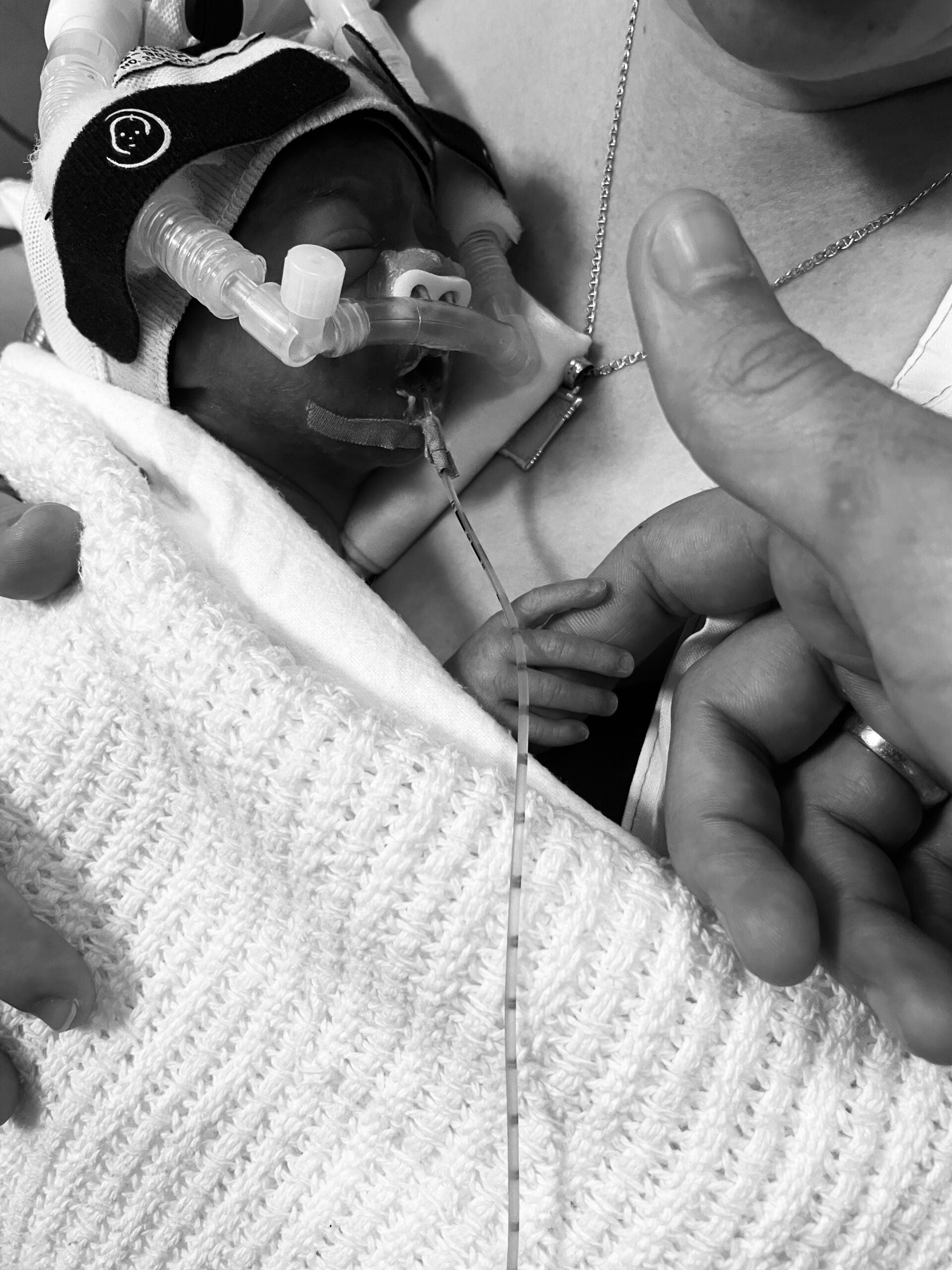Premature Babies