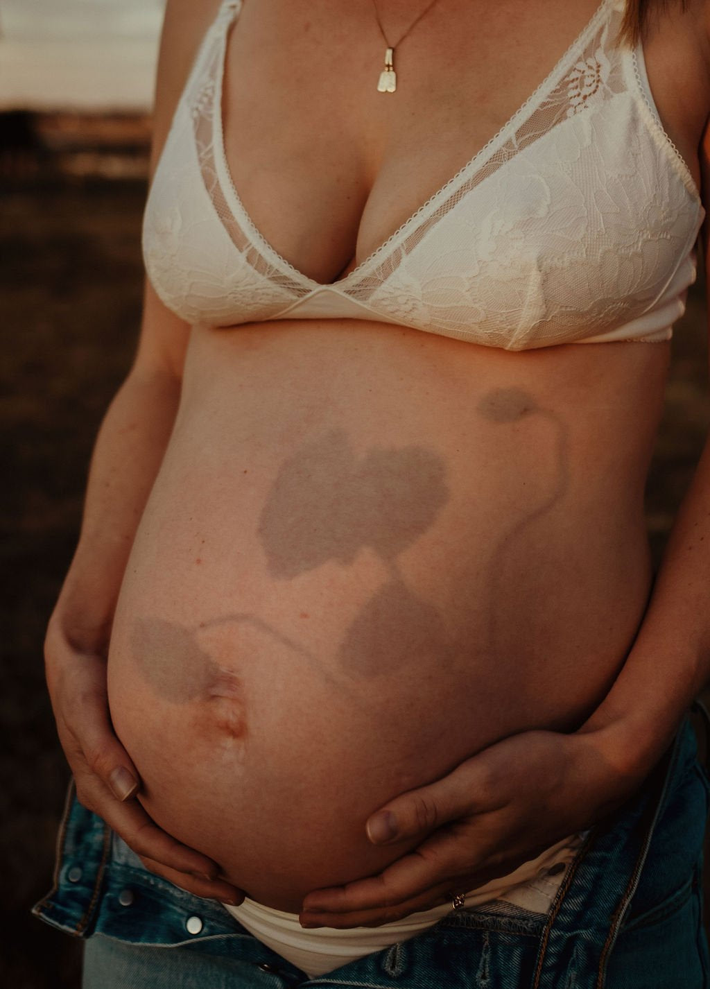 Preparing for Pregnancy